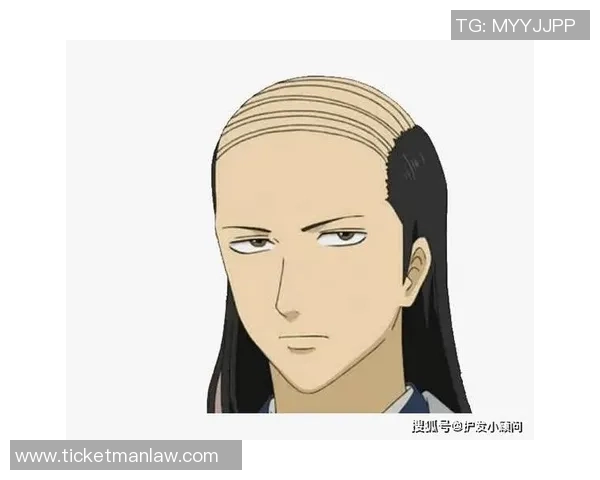 27岁麦卡坦言脱发经历宁愿剃光头也不愿意再戴假发